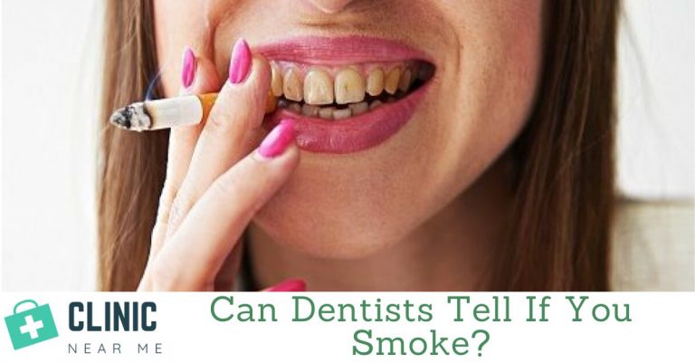 Can Dentists Tell If You Smoke? - Clinic Near Me